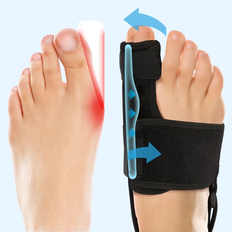 Valgux™ Skinne | Tåkorrektor mod skæv storetå (Hallux Valgus)
